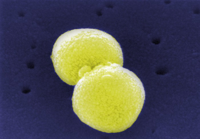 Streptokokken Pneumoniae